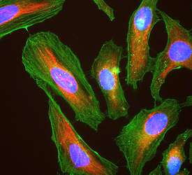 HeLa_cells_stained_with_antibody_to_actin_(green)%2C_vimentin(red)and_DNA(blue)